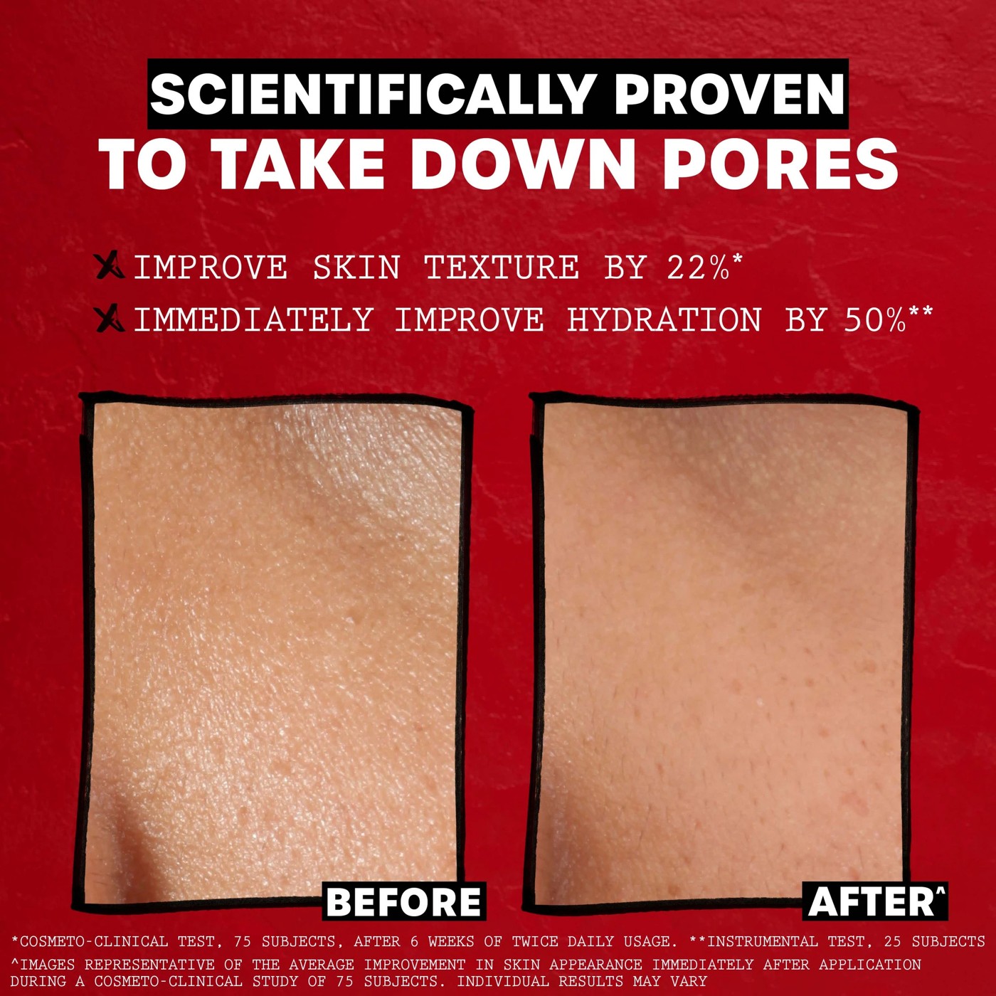 Thayers Unscented Alcohol Free Facial Toner 355ml - Witch Hazel and Aloe Vera 5 of 5