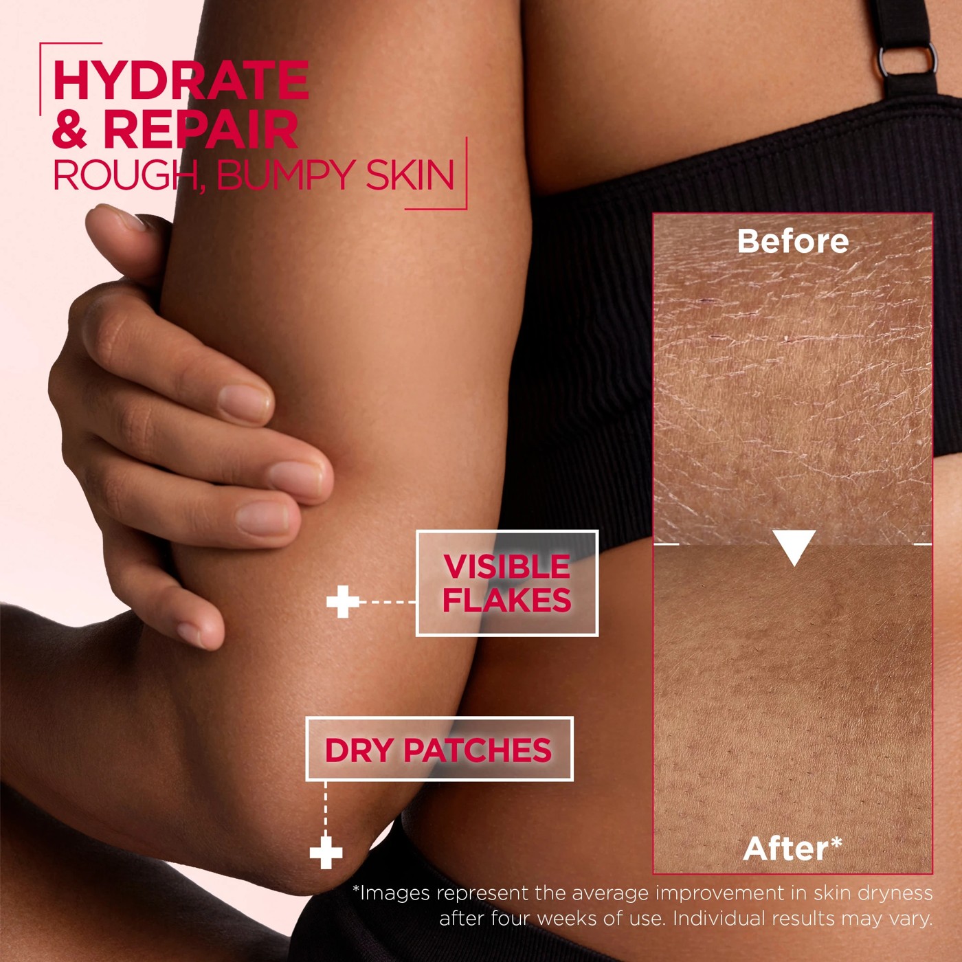 Mixa Urea Cica Repair+ Renewing Cream 400ml 5 of 5