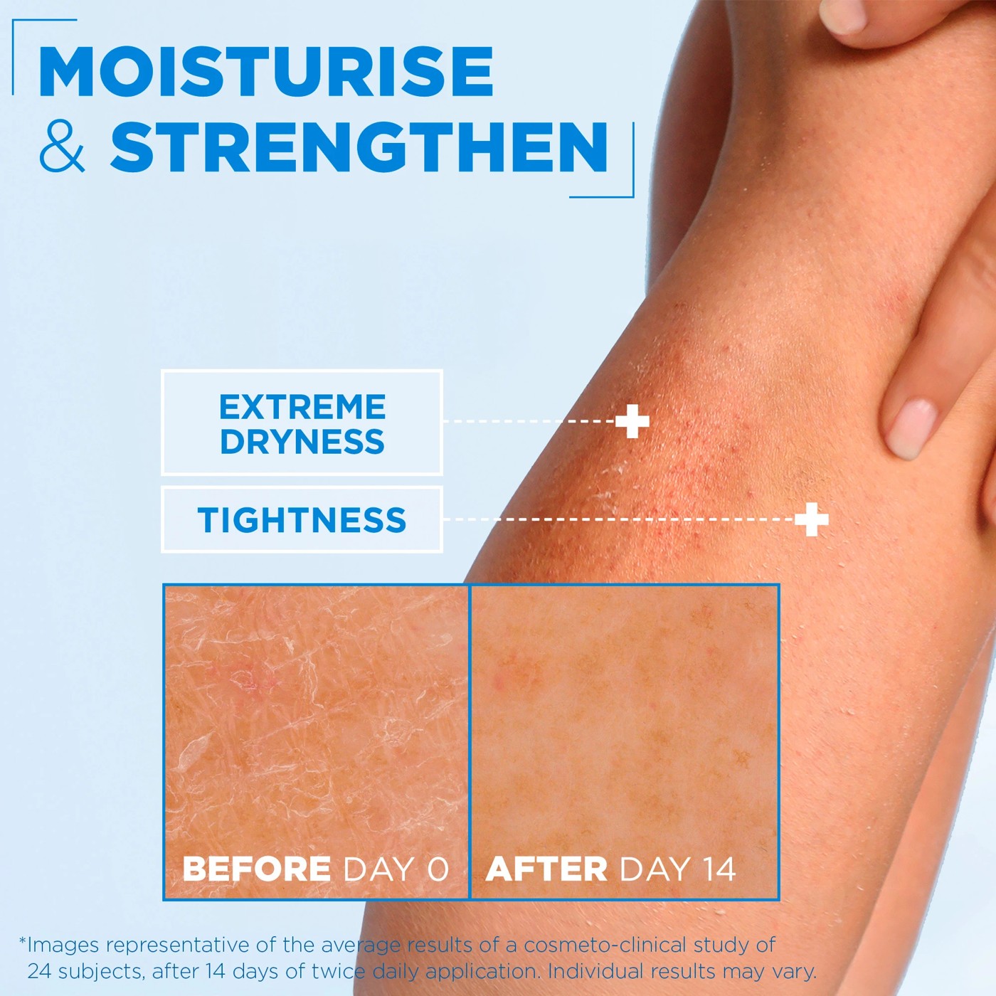 Mixa Ceramide Protect Stentening Cream 400ml 5 of 5