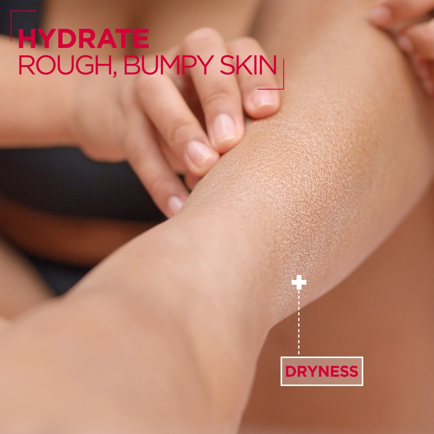 Mixa Urea Cica Repair+ Body Milk 400ml 4 of 5